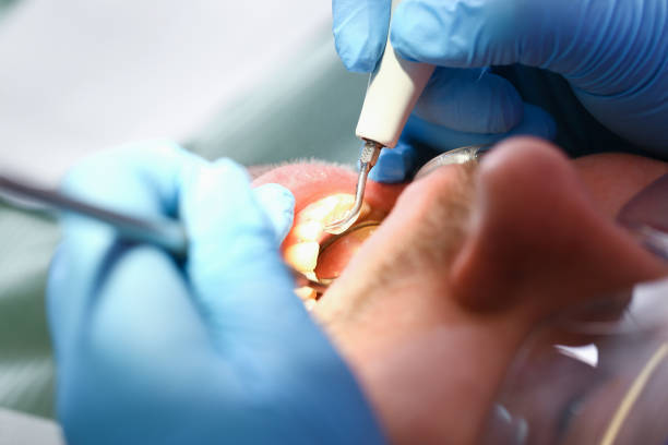 Best Tooth Infection Emergency Dentist  in Haskins, OH