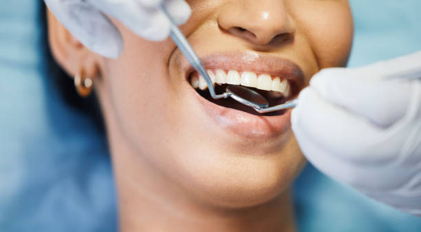 Best Knocked-Out Tooth Emergency  in Haskins, OH